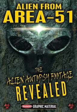 Alien from Area 51: The Alien Autopsy Footage Revealed (missing thumbnail, image: /images/cache/101518.jpg)