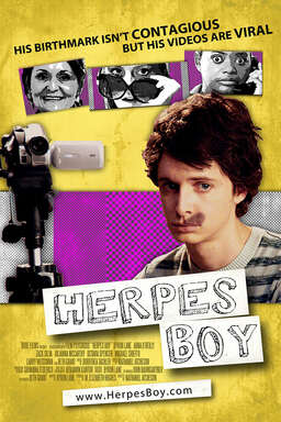 Herpes Boy (missing thumbnail, image: /images/cache/156164.jpg)