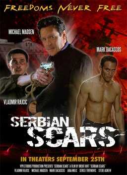 Serbian Scars (missing thumbnail, image: /images/cache/174198.jpg)