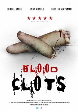 Blood Clots (missing thumbnail, image: /images/cache/5415.jpg)