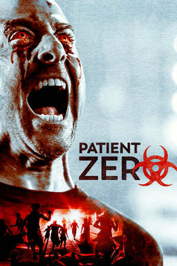 Patient Z (missing thumbnail, image: /images/cache/77546.jpg)