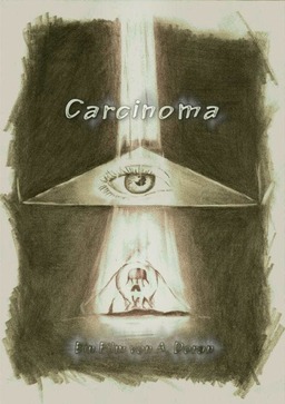 Carcinoma (missing thumbnail, image: /images/cache/97742.jpg)